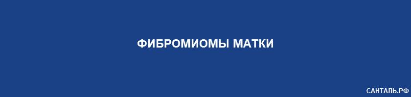 Фибромиомы матки Фибромиомы матки
