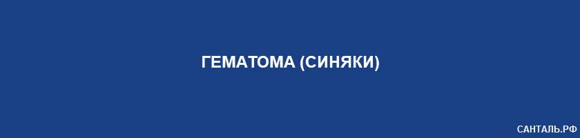 Гематома (синяки) Гематома (синяки)