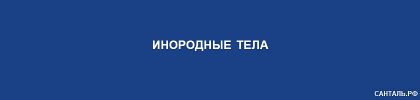 Инородные тела Инородные тела