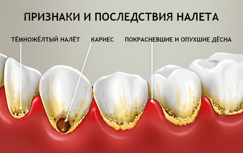 признаки и последствия налета признаки и последствия налета